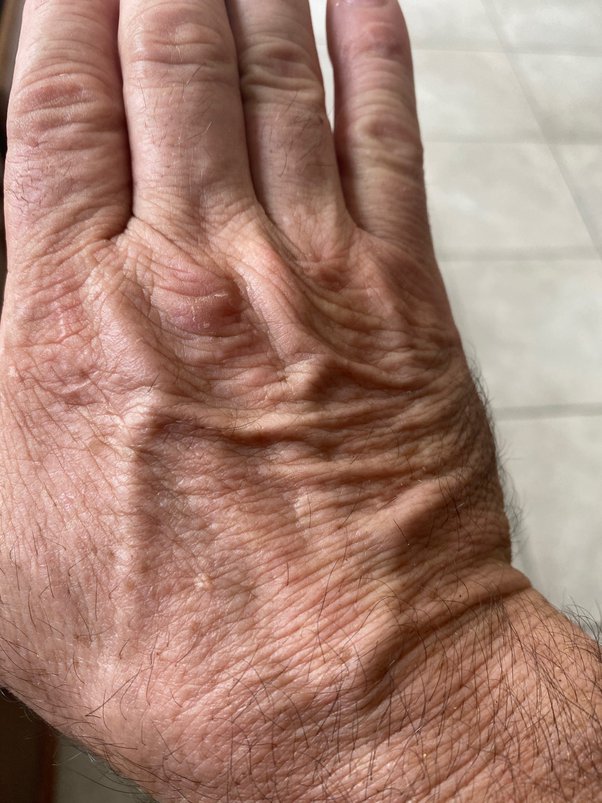 Crushing Fist: The Punch That Hits Harder Than Expected!