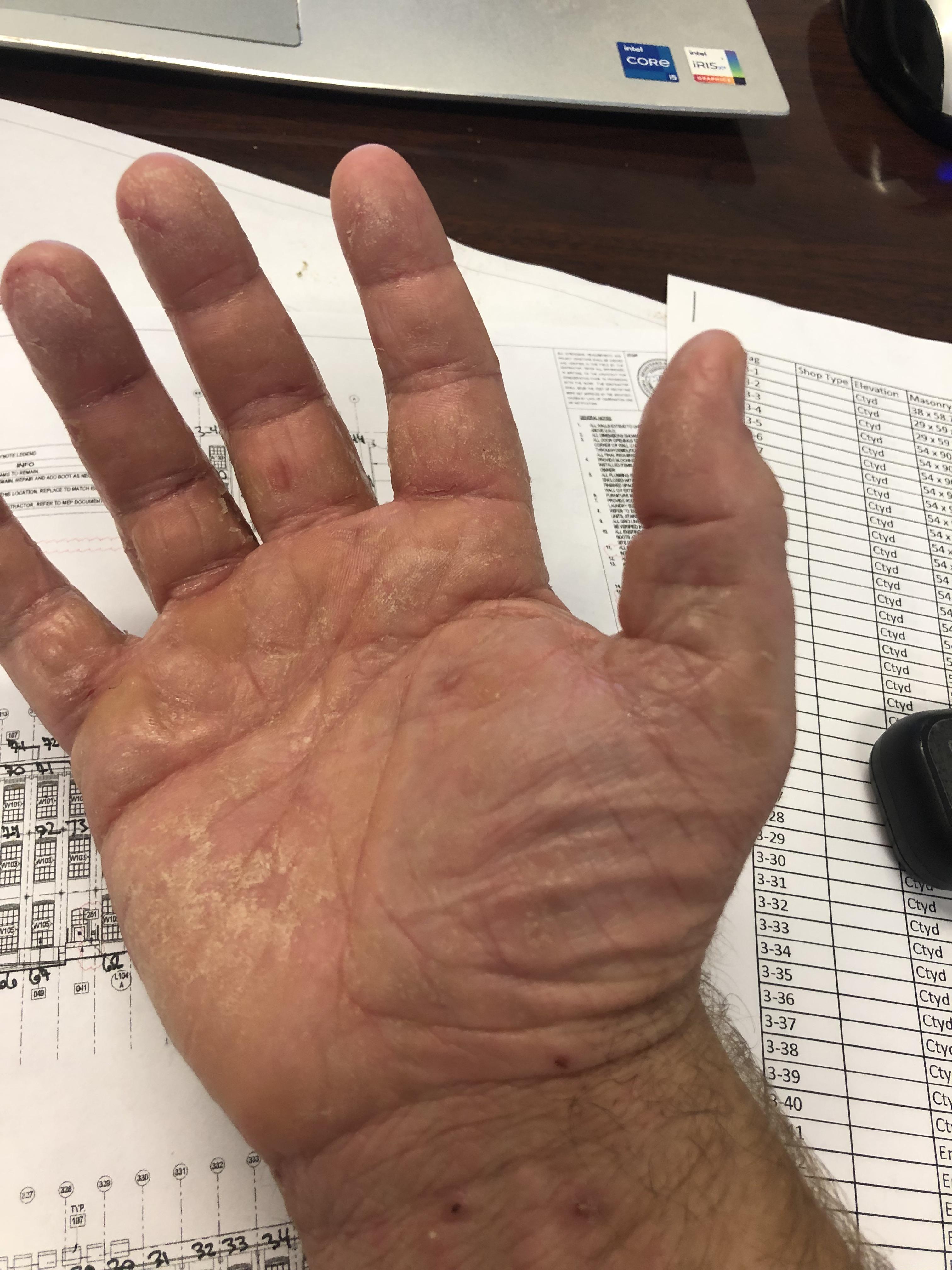 Cracked Dendrocluster: What is it and How to Fix It?